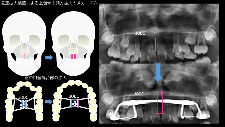 純 矯正 歯科クリニック