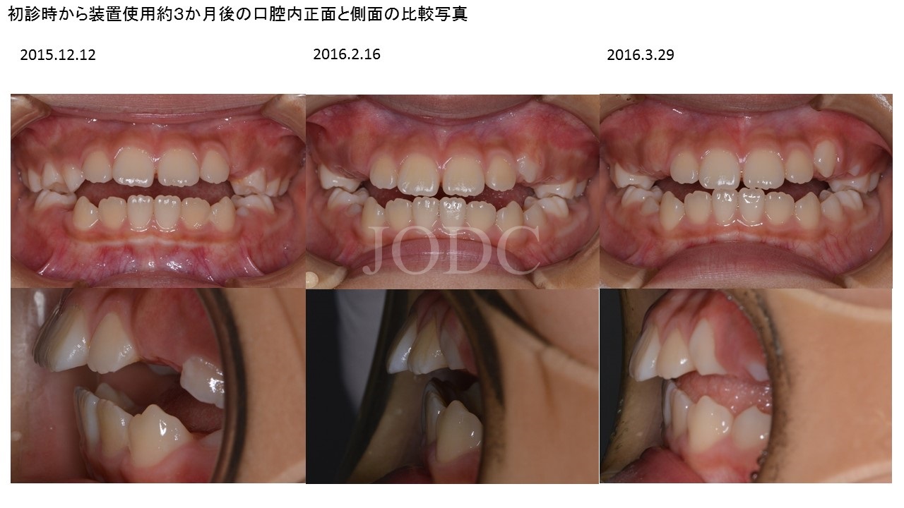 純 矯正 歯科クリニック